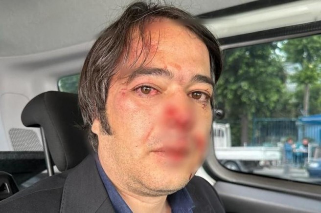İstanbul Üsküdar sahilinde yapılan kaçak yapı yıkımında İBB ekibine saldırı